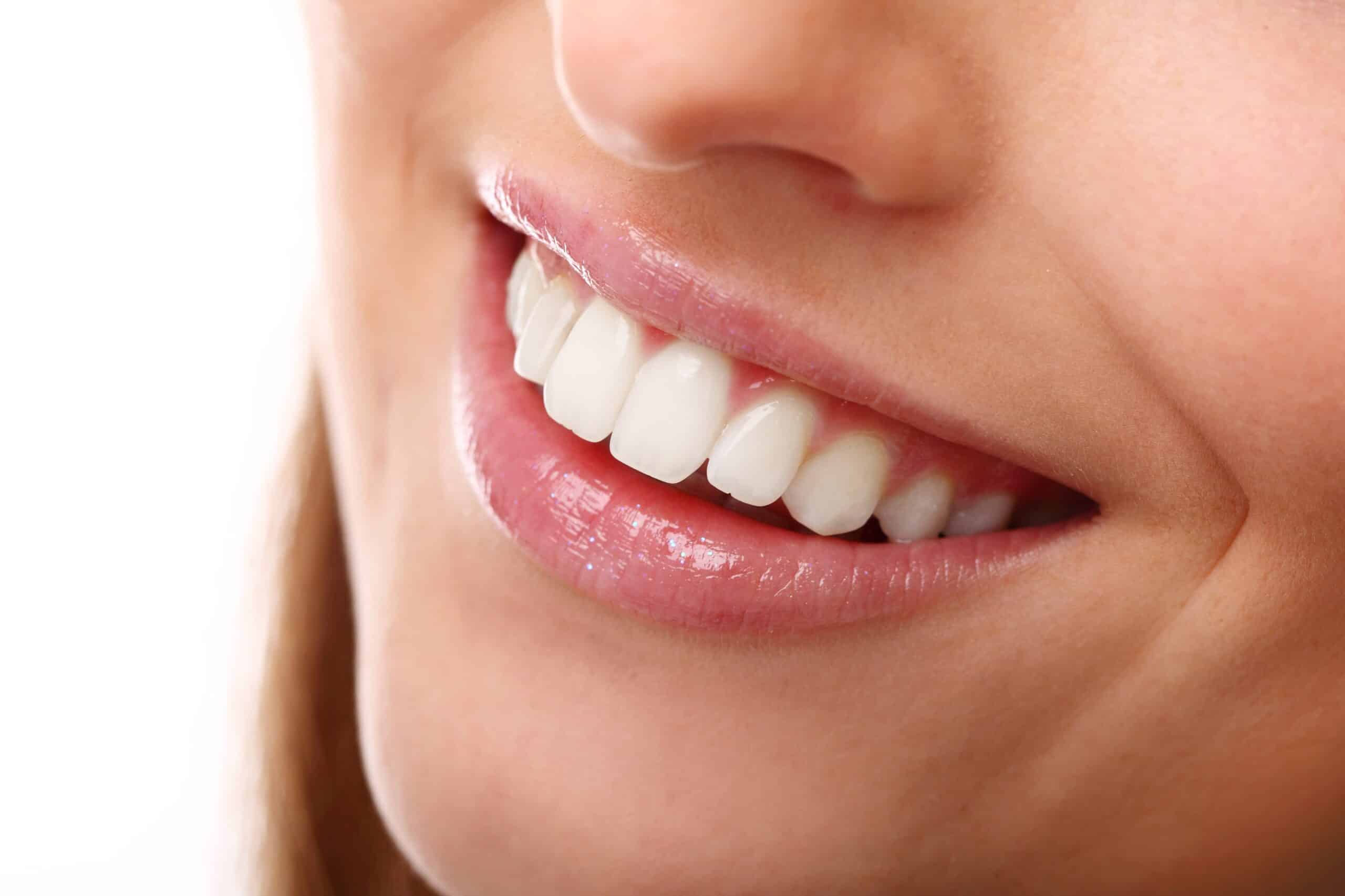 Sonrisa radiante: Consejos para mantener tu blanqueamiento dental