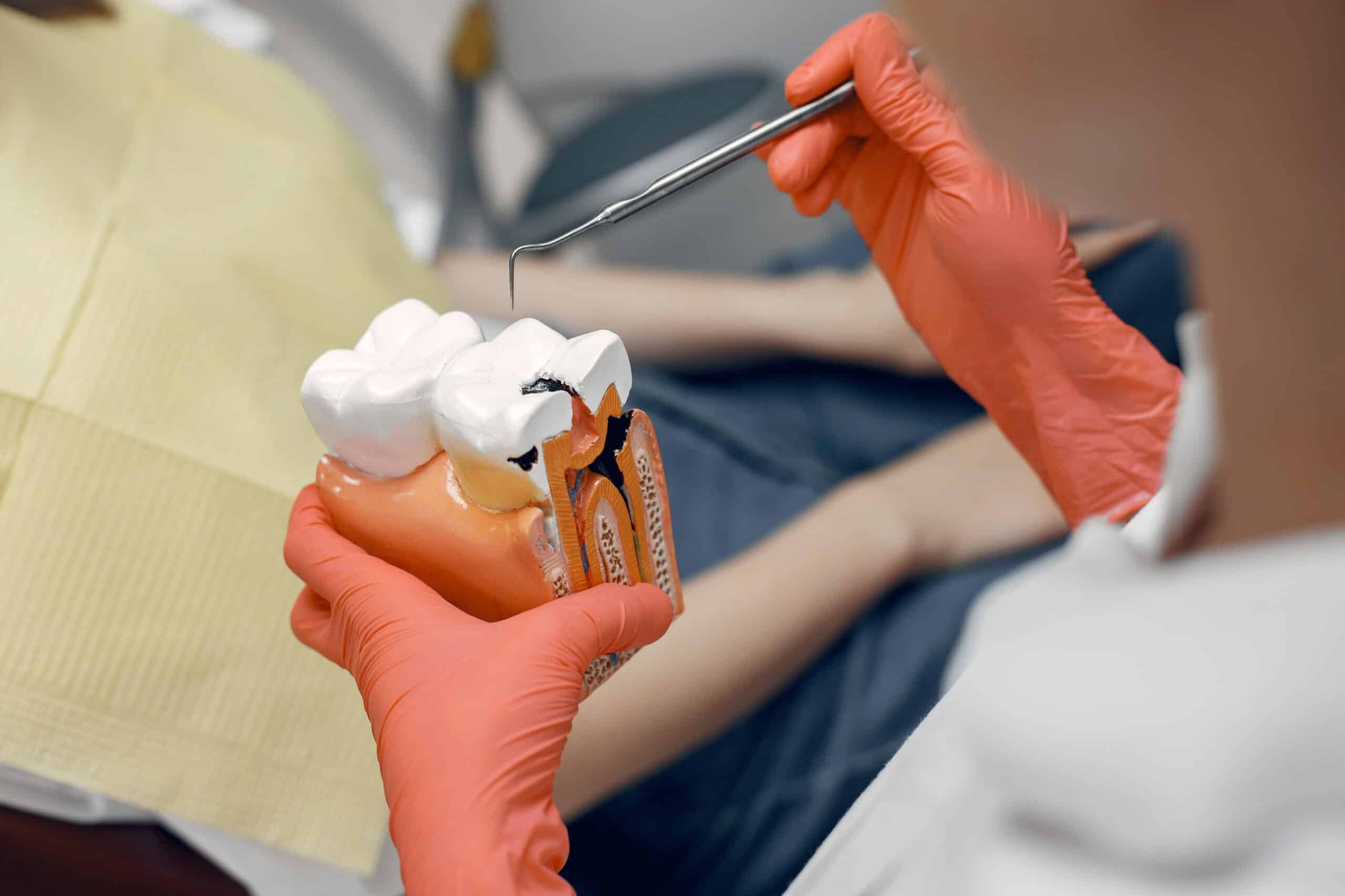 Descubre la Importancia de la Endodoncia: Salvando Sonrisas desde el Interior