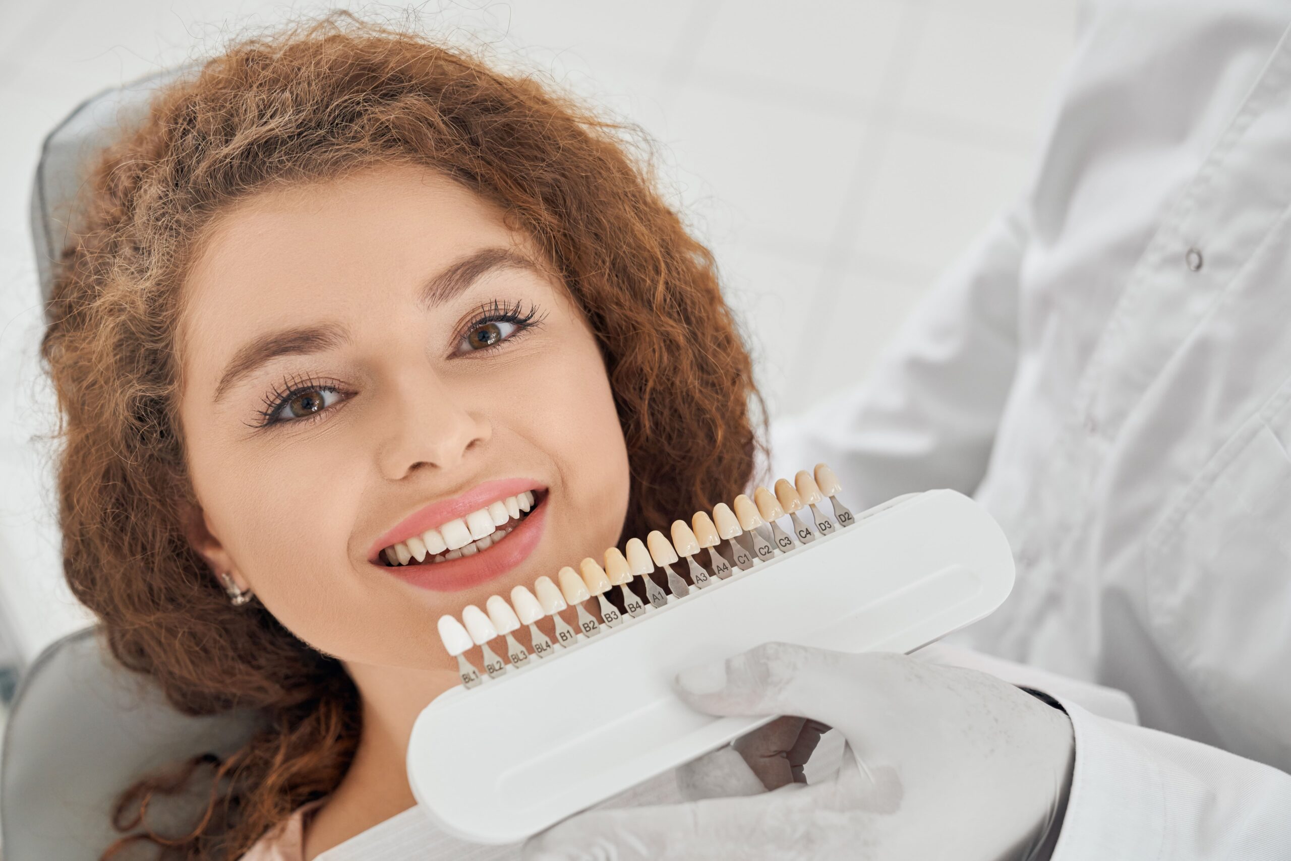 Descubre la Sonrisa Perfecta: Todo lo que Necesitas Saber sobre las Carillas Dentales