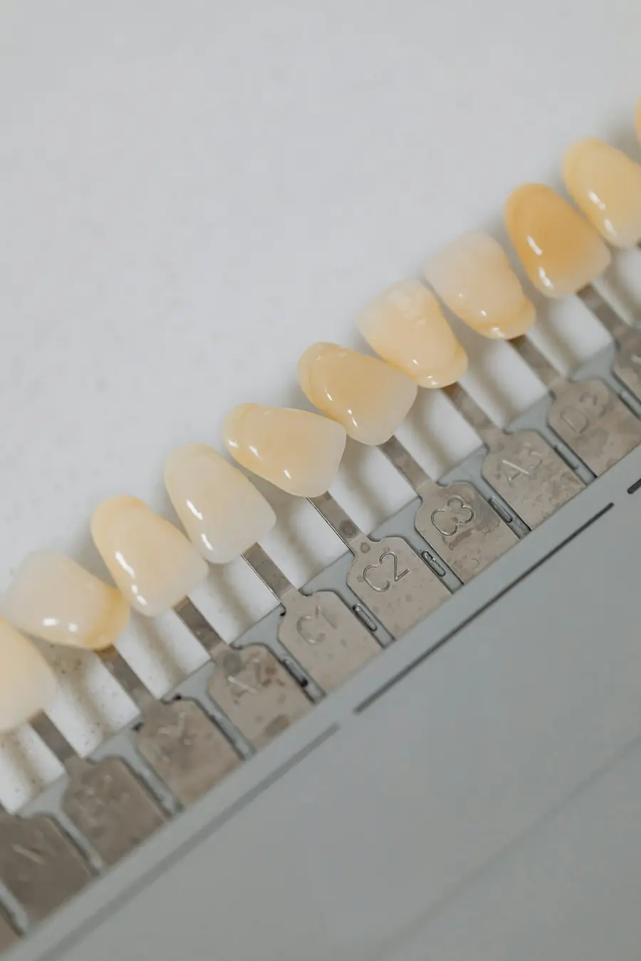 Implantes Cigomáticos: Una Solución Innovadora para la Pérdida Dental Extrema